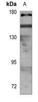 Histone Deacetylase 6 (phospho-S22) antibody