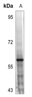 MST1/2 (phospho-T183) antibody
