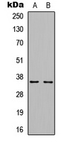 Cyclin D1 (phospho-T286) antibody