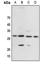 YWHAZ (phospho-T232) antibody