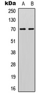 CDC25A (Phospho-S178) antibody