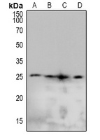 CAV2 (phospho-Y19) antibody