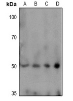 TPH1 (phospho-S58) antibody