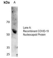 COVID-19 Nucleocapsid protein antibody