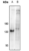 NFAT1 (pS326) antibody