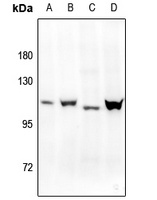 Progesterone Receptor (pS400) antibody