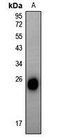 Alpha-crystallin B (pS59) antibody