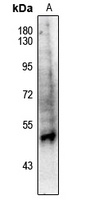 PPAR alpha (pS21) antibody