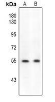 ETS1 (pS282) antibody