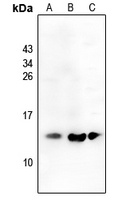 MIP3 beta antibody