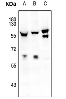 FOXO1/3/4 (pT24/32) antibody
