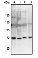 ZAP70 (pY292) antibody