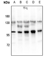 Glucocorticoid Receptor (pS203) antibody
