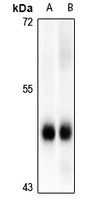 MK2 (pS272) antibody
