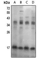 FHIT (pY114) antibody