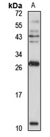 MIP3 beta antibody