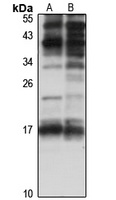 Perp antibody