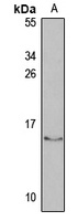 CD27BP antibody