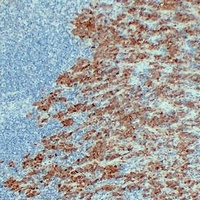S100-A1 antibody