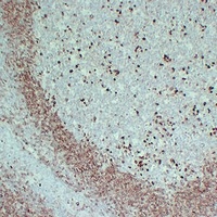 CD79a antibody