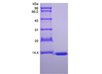 Recombinant Murine Fatty-acid-binding Protein 1