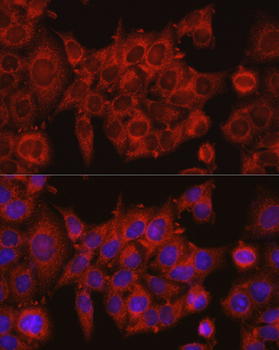 IDH1 antibody