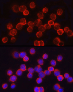 ASNS antibody