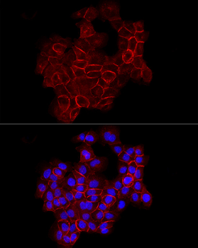 CDH1 antibody