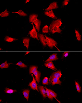 ENO2 antibody