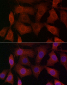 TRPV1 antibody