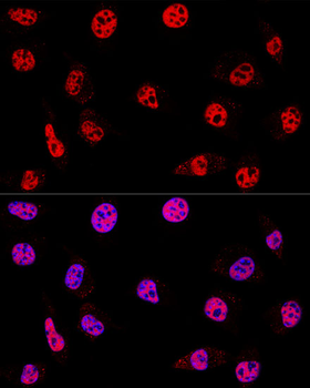 HDAC1 antibody