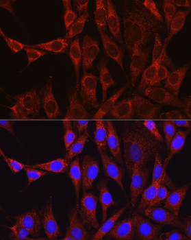 GLUL antibody