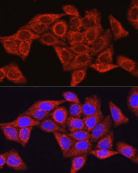 Glutamine Synthetase (GLUL) Rabbit Antibody