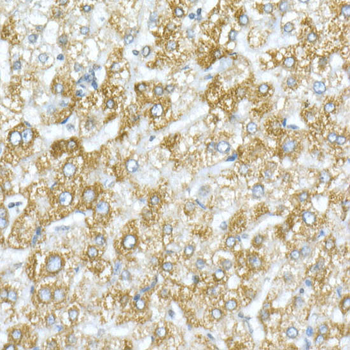 VDAC1 / Porin Rabbit Antibody