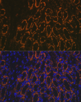 AMACR antibody