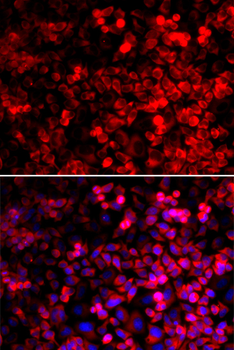 QARS antibody