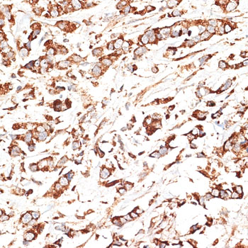 KLHL9 antibody