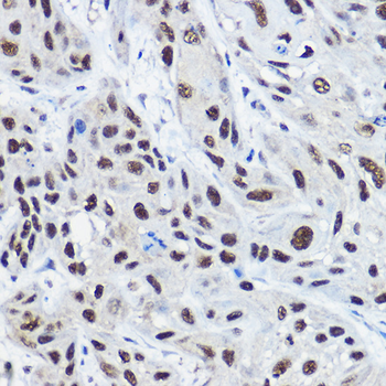 NCOA2 antibody