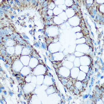 UQCRC2 antibody