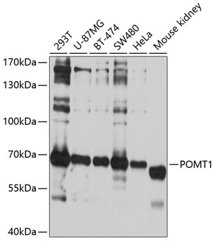 POMT1 antibody