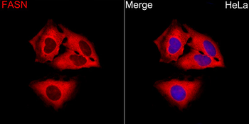 FASN antibody