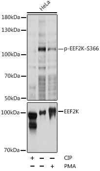 EEF2K (Phospho-S366) antibody