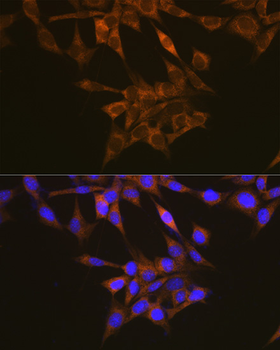 FLT1 antibody