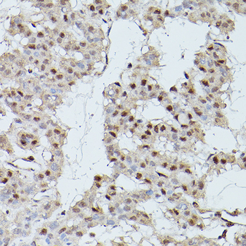 CDK9 antibody