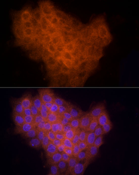 CYR61 antibody