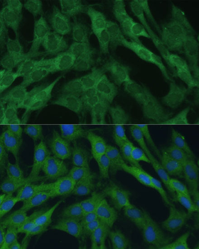 IDH1 antibody