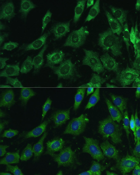 Galectin 3 antibody