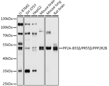 PPP2R2B antibody