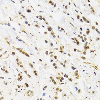 RAD50 antibody