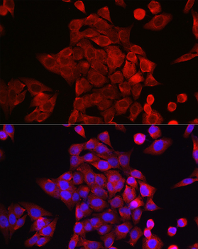 STAT6 antibody